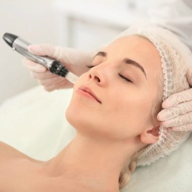 dermapen-microneedling-768x768