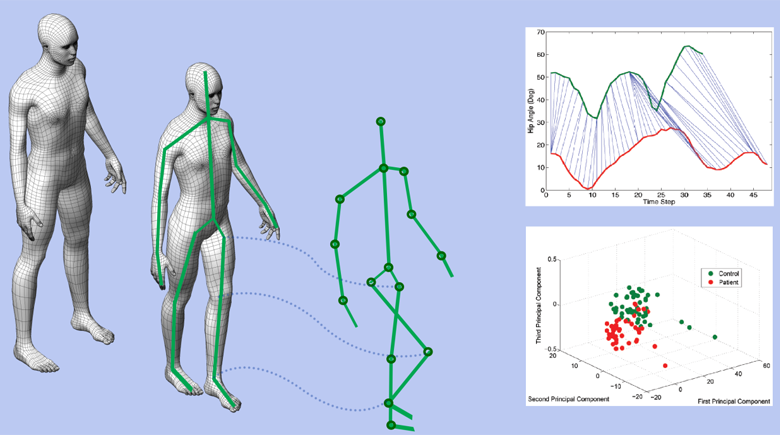 Functional Gait Assessment: Performance Precursor and Disease Marker