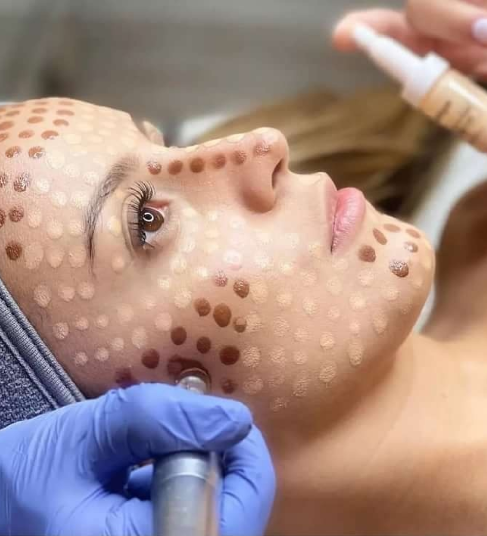 BB Glow Facial (1)